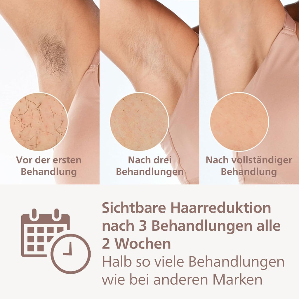 Philips Lumea IPL Serie 9000 – Epilatore a luce pulsata con tecnologia SenseIQ, 3 accessori per corpo, viso e zone di precisione, senza fili (modello BRI955/00)